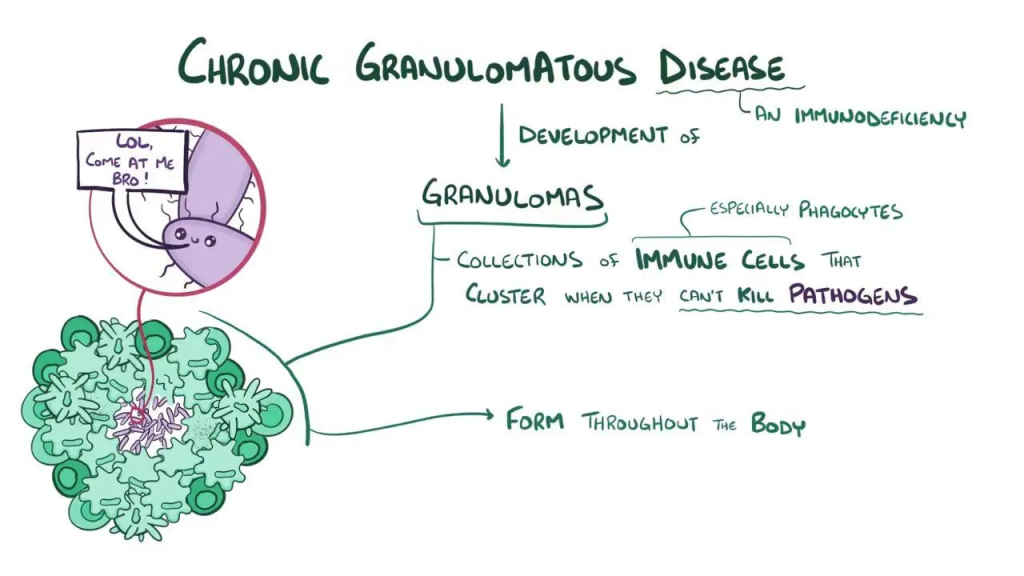Chronic Granulomatous Disease (CGD) is a rare inherited disorder in which certain white blood cells called phagocytes cannot produce reactive oxygen species necessary to kill certain bacteria and fungi.