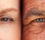 Wrinkles are visible lines, folds, or creases that develop in the skin, commonly as a result of aging and environmental factors.