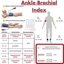 The Ankle-Brachial Index (ABI) is a simple, non-invasive diagnostic test used to assess peripheral arterial disease (PAD) by comparing the blood pressure measured at the ankle with the blood pressure measured at the arm (brachial artery). It helps determine the presence and severity of arterial blockages that can restrict blood flow to the legs and feet123.