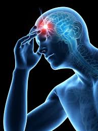 Neurotoxicity (NTX) refers to damage or adverse effects on the nervous system—comprising the brain, spinal cord, and peripheral nerves