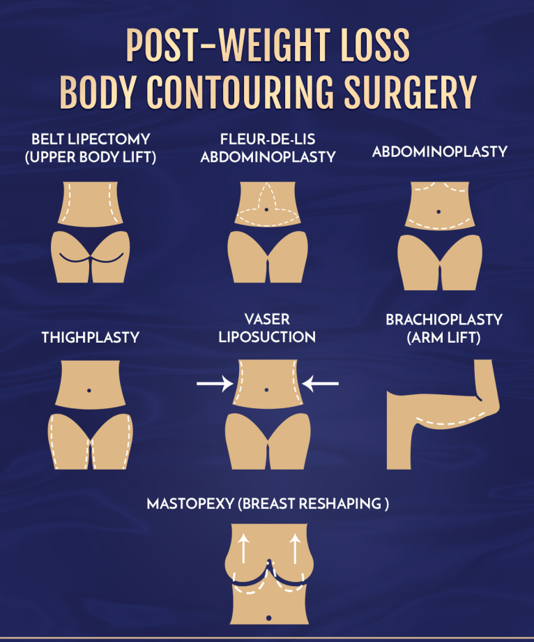 Body Contouring Surgery at PASCAL, KCCS in Gangnam, Seoul
