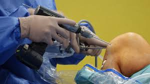 Labrum (Lb) is a ring of fibrocartilaginous tissue found in ball-and-socket joints, most notably the shoulder (glenoid labrum) and hip (acetabular labrum).