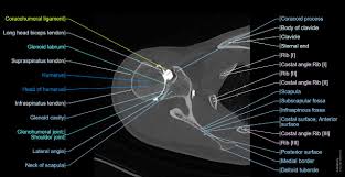 CT arthrograms are advanced imaging procedures that involve the injection of iodinated contrast material directly into a joint, followed by computed tomography (CT) scanning.