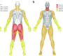 Muscular weakness, also known as myasthenia or muscle fatigue, refers to a reduced ability of a muscle to generate force. It can affect one muscle or many muscles and can be temporary or chronic. Weakness can be caused by neurological, muscular, or systemic conditions and may impact mobility, strength, and daily functioning.