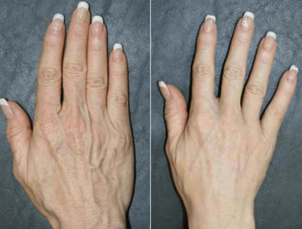 Hands and décolletage at PASCAL, KCCS in Gangnam, Seoul