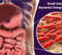 Small Intestinal Bacterial Overgrowth (SIBO) is a condition where there is an abnormal increase in the number and/or type of bacteria in the small intestine.