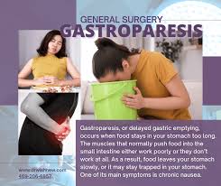 Gastroparesis is a chronic disorder characterized by delayed gastric emptying without any physical obstruction.