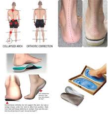 Orthotics are specialized external devices designed to support, align, prevent, or correct deformities or abnormalities in the musculoskeletal system. These devices can improve the function of affected body parts, alleviate pain, and enhance mobility123. Orthotics are used across various parts of the body and are custom-made or off-the-shelf, depending on the condition and needs of the individual.
