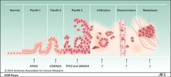 Precancerous skin lesions are abnormal skin growths or patches that have the potential to develop into skin cancer if left untreated. They represent an intermediate stage between normal skin and invasive cancer, often resulting from chronic sun damage.