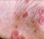 Erythema (ERM) is redness of the skin or mucous membranes, caused by increased blood flow (hyperemia) in superficial capillaries.