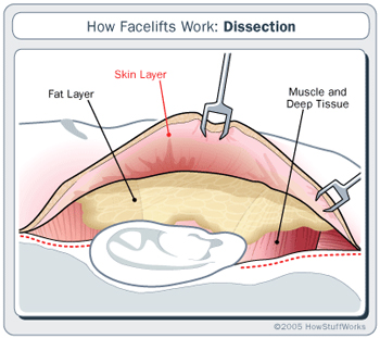 The cheeks significantly influence facial aesthetics through contour, volume, and symmetry. Common concerns include: