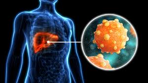 Hepatitis B virus (HBV) is a DNA virus causing infection of the liver, presenting as acute or chronic hepatitis.
