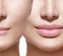 Lips and Cosmetic Surgery aims to enhance lip volume, shape, and definition to achieve a youthful and balanced facial aesthetic.