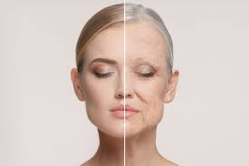 Facial aging is a complex and multi-layered process involving structural changes to the skin, subcutaneous fat, muscles, ligaments, and facial bones. These changes lead to characteristic signs such as wrinkles, volume loss, sagging, skin laxity, and altered facial contours.