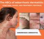 Seborrheic dermatitis is a common, chronic, or relapsing inflammatory skin condition that affects oily (sebaceous) areas of the body such as the scalp, face (around the nose, eyebrows, ears), and trunk.