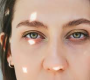 Hooded eyelids occur when excess skin folds downward from the brow bone, covering the crease of the upper eyelid.